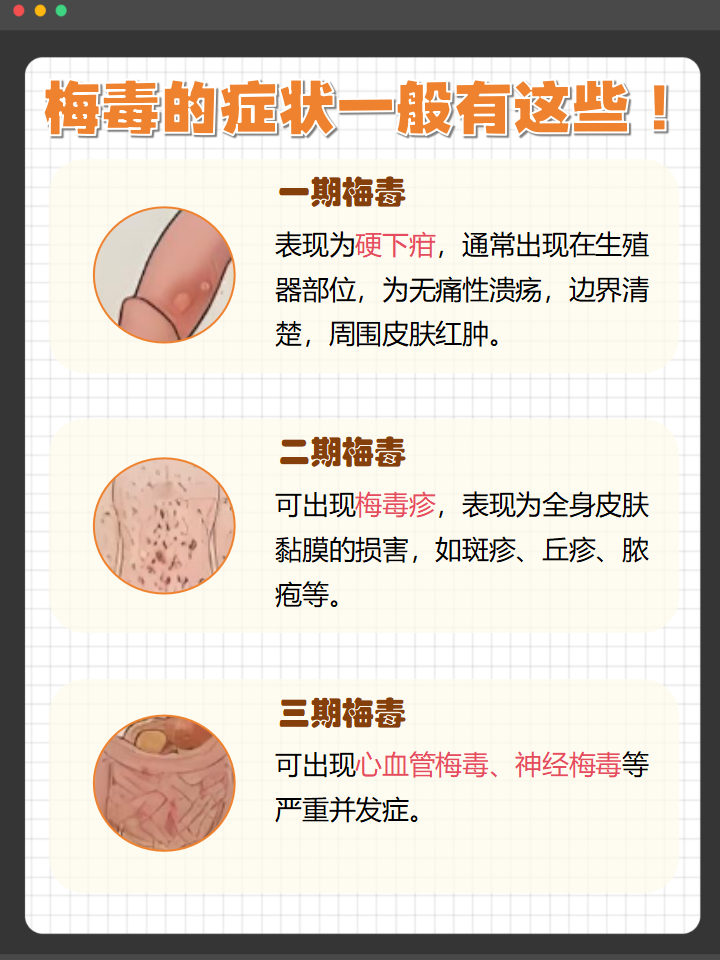 研究人员发现迄今最早梅毒螺旋体感染记录