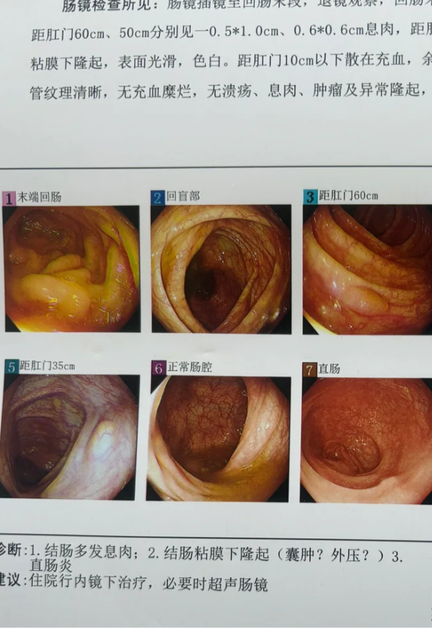 上海医药获得发明专利授权：“治疗炎性肠病的方法”
